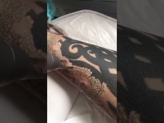 máquina do laser do pico segundo para a remoção da tatuagem